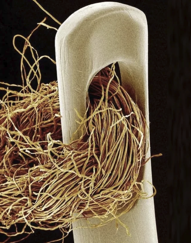 Needle and thread under an electron microscope